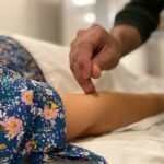 A close-up of a person receiving acupuncture therapy on their arm, with a practitioner carefully inserting a thin needle.