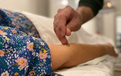 Acupuncture: Health Benefits