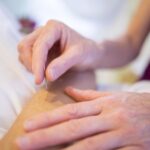 A close-up of an acupuncturist inserting a thin, sterile acupuncture needle into a patient's forearm during a treatment session.