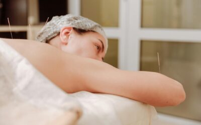 Acupuncture: Post-Treatment Care